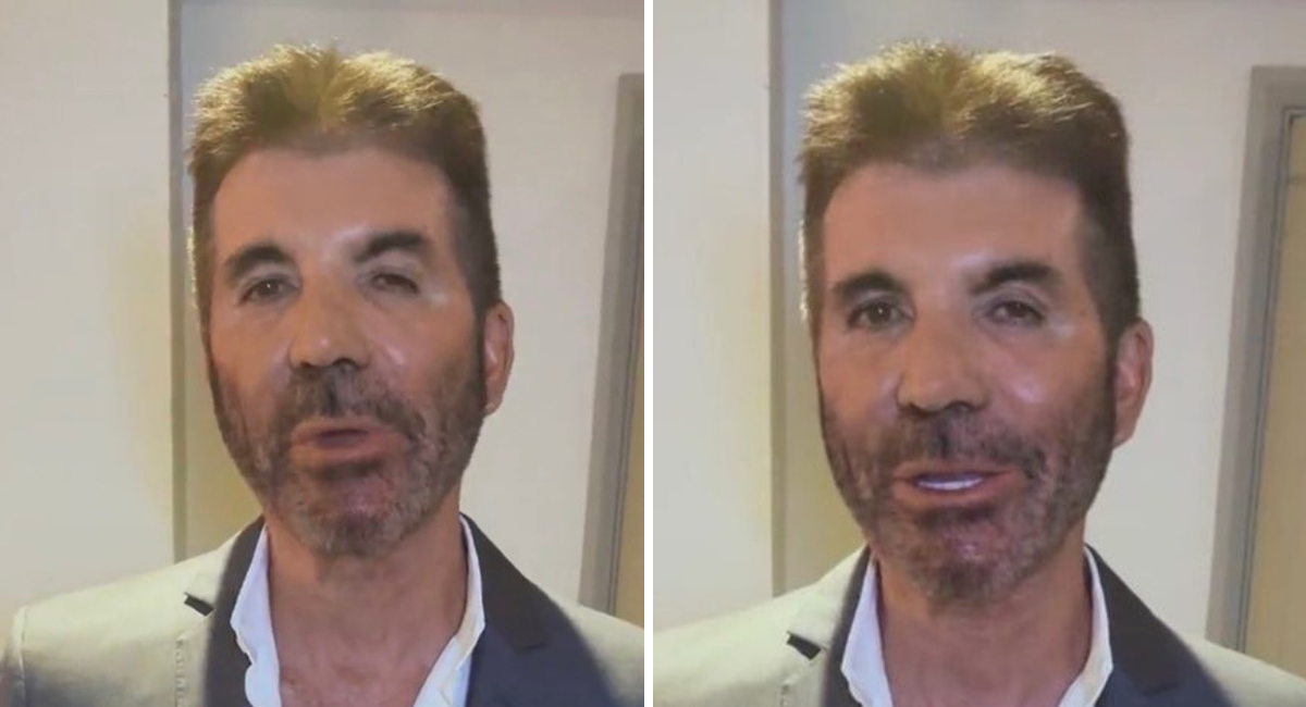 O que é que aconteceu à cara de Simon Cowell? Estrela de “America’s Got Talent” está irreconhecível