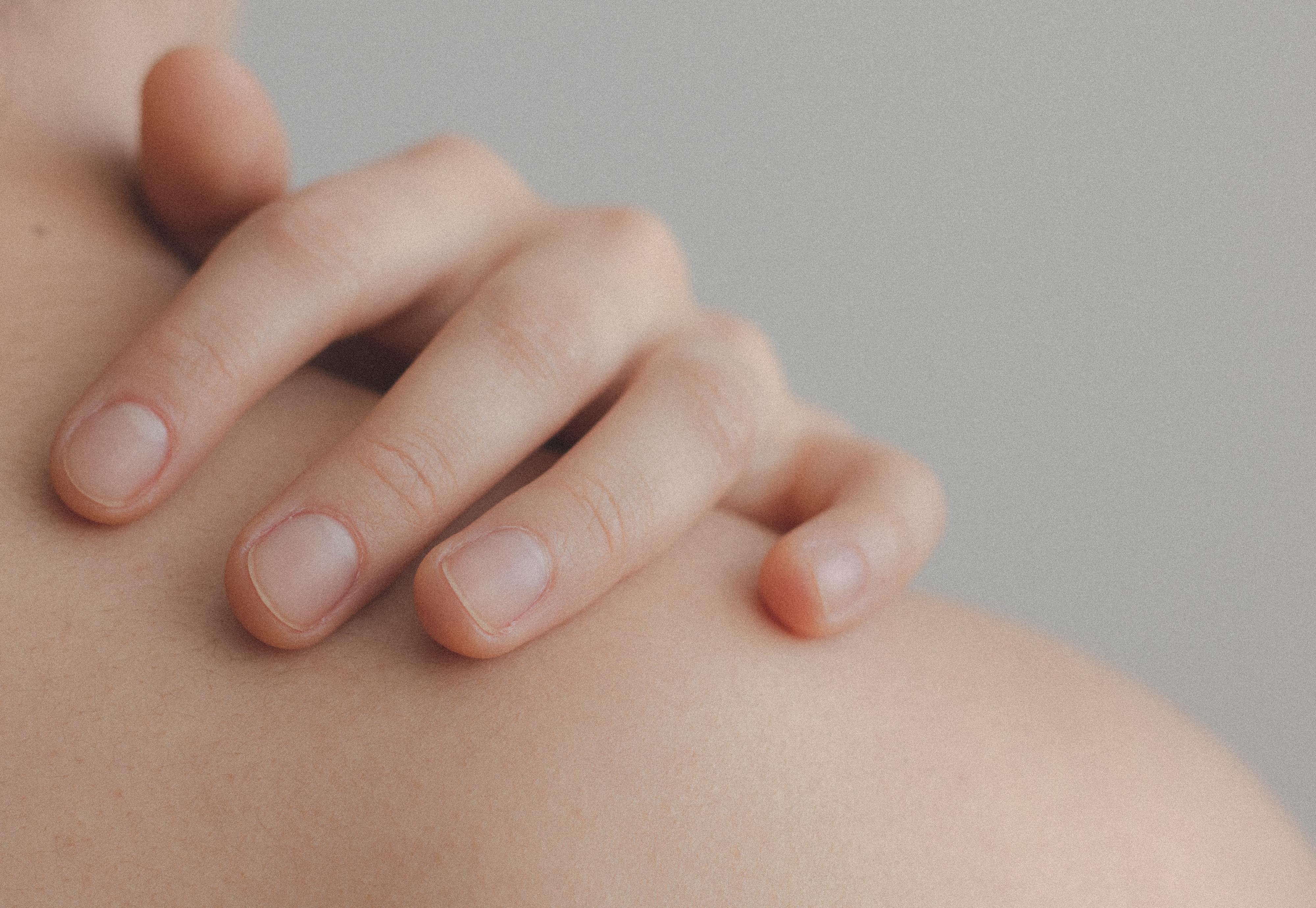 Sofia não conseguia pegar numa caneta de tão cansada. Meses e especialistas depois, chegou o diagnóstico: lúpus