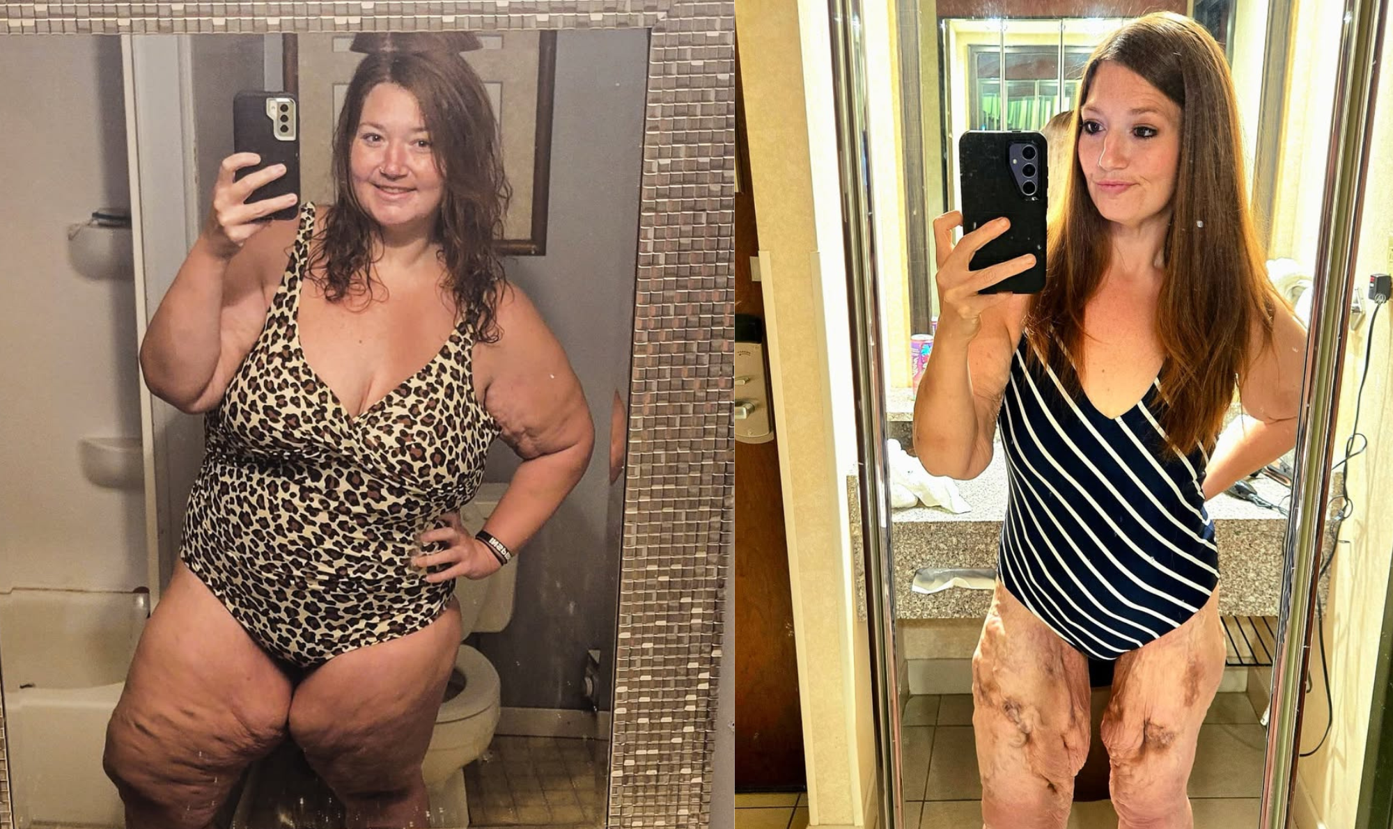 Influencer perdeu 136 quilos após passar por doença rara. Veja o antes e depois de Lexi Reed