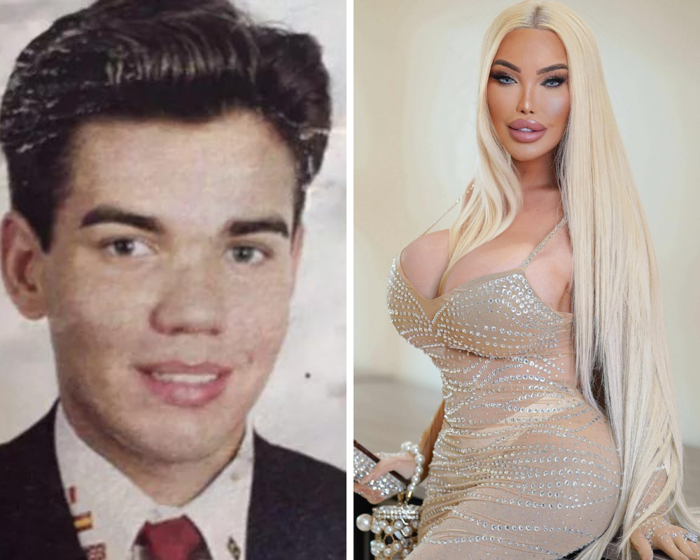 Estas duas imagens são da mesma pessoa. Conheça a história de Jessica Alves, ex-Ken Humano