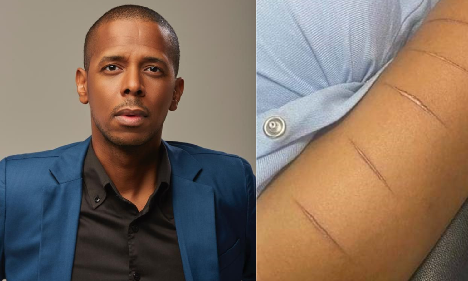 Mulher de jornalista angolano torturada com 16 cortes em frente ao filho de 1 ano. “Foi um aviso”