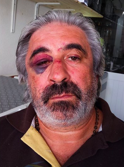 Dono de restaurante de Benavente espancado por pais de jovens que andam a incomodar outros clientes