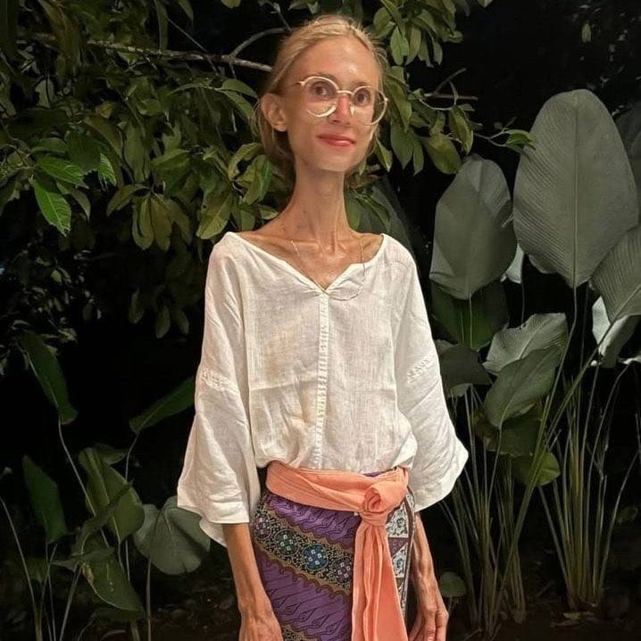 Bailarina e influencer de 27 anos morre de desnutrição com apenas 22 quilos. Só comia fruta