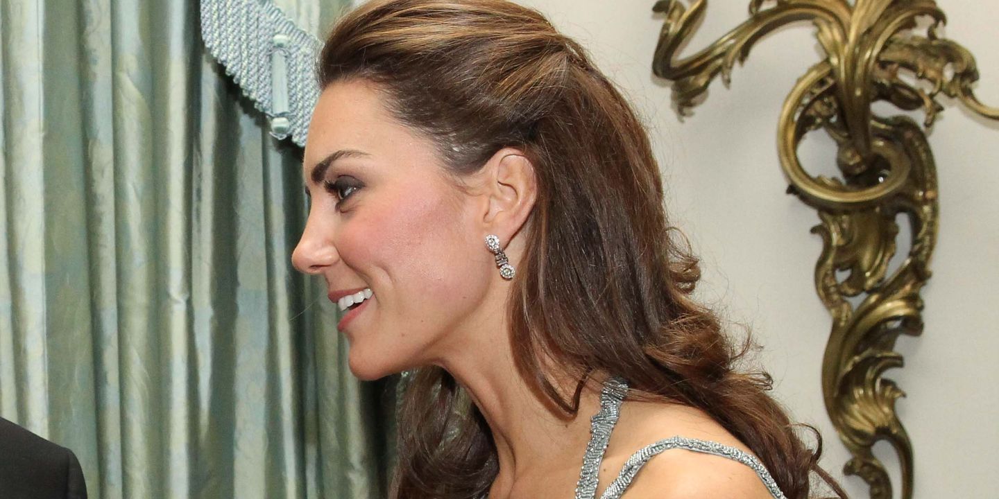 A história da cicatriz secreta que Kate Middleton tem na cabeça