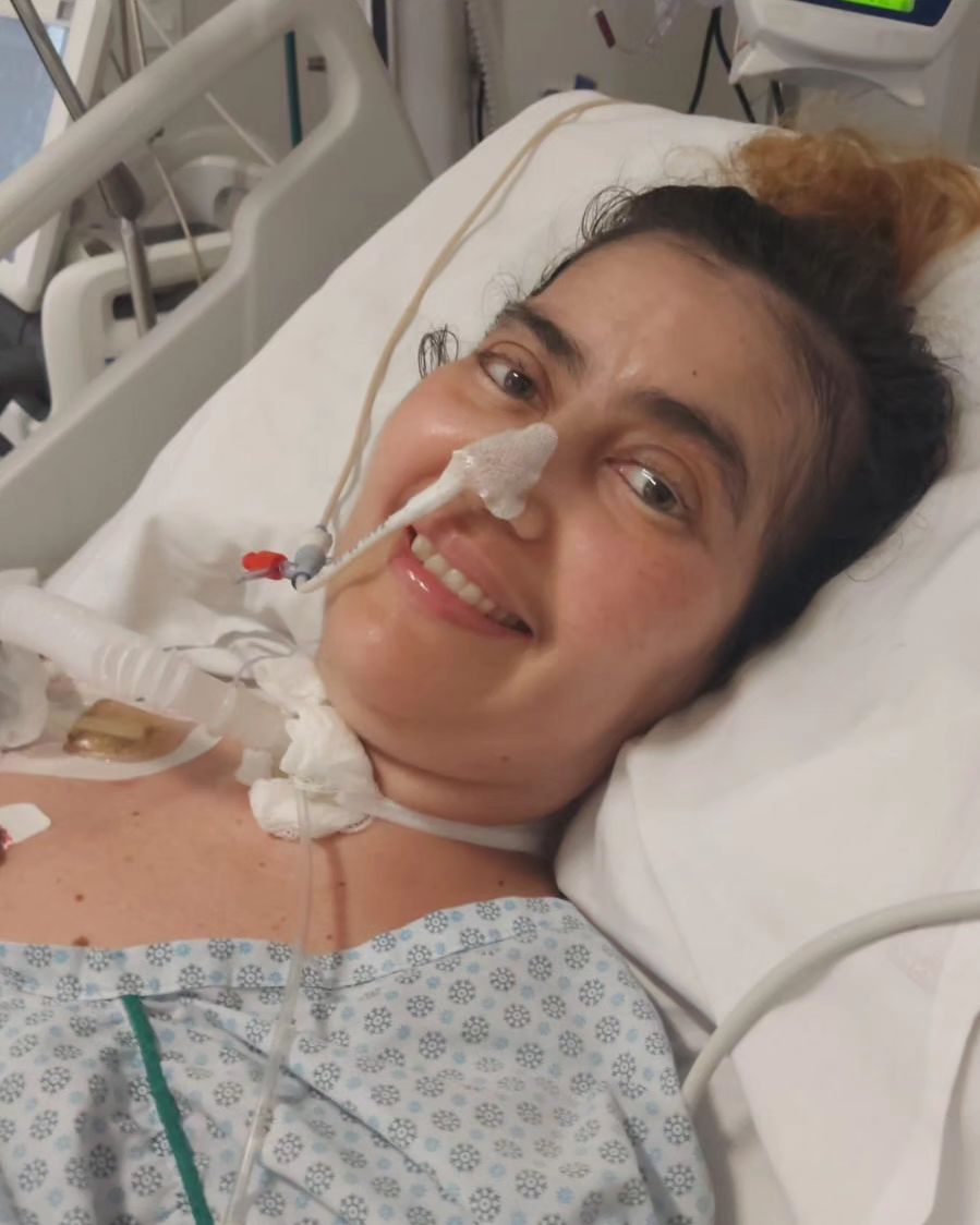 Esta mulher deixou de andar e esteve 1 ano internada após comer molho contaminado com bactéria