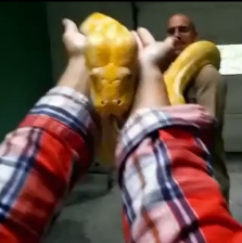 A pílula faz mal? E engorda ou isso é apenas um mito? Uma ginecologista explica