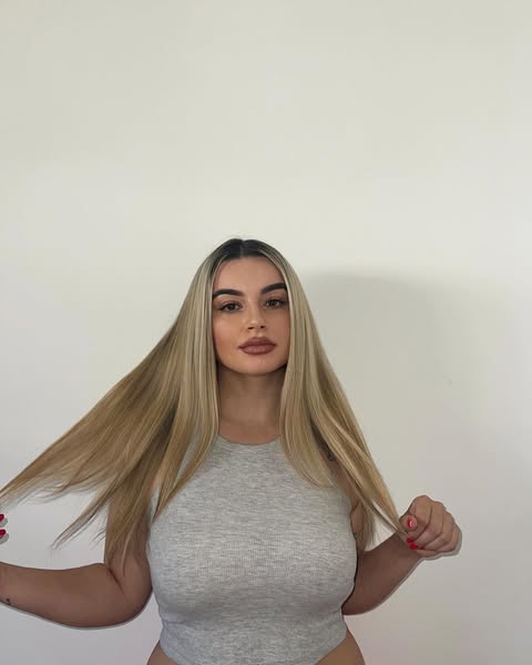 Ex-concorrente de reality show da TVI atropelada em passadeira. “Fui projetada uns metros”