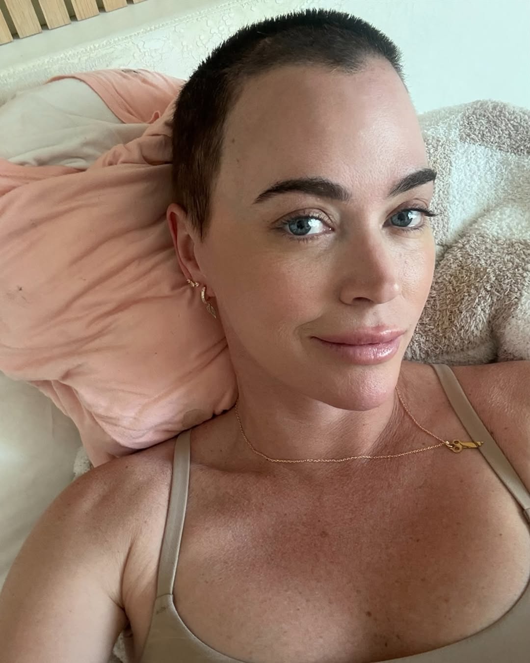 Ex-estrela de reality show revelou ter 3 tumores no cérebro e 2 nos pulmões – e já removeu 17 melanomas