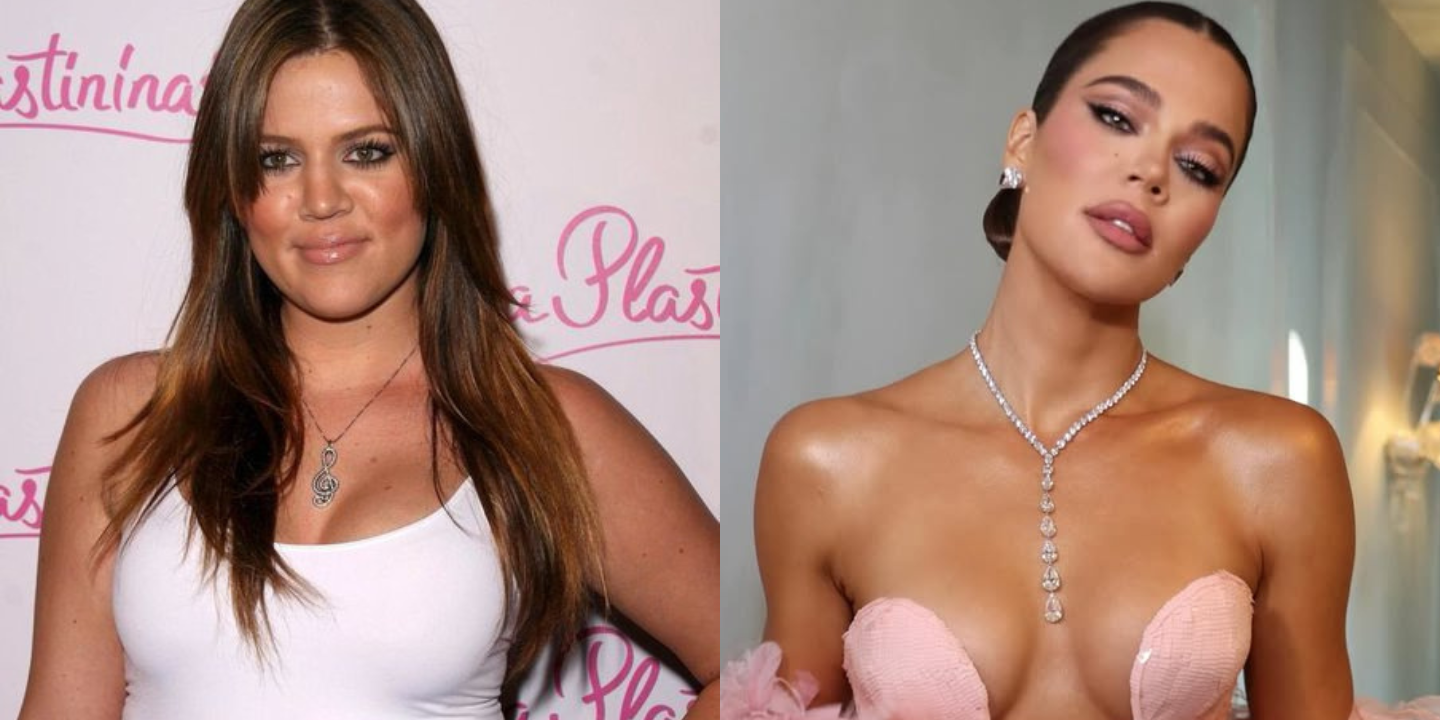 Da rinoplastia ao botox, Khloé Kardashian revelou todos os procedimentos estéticos que já fez (e faz)