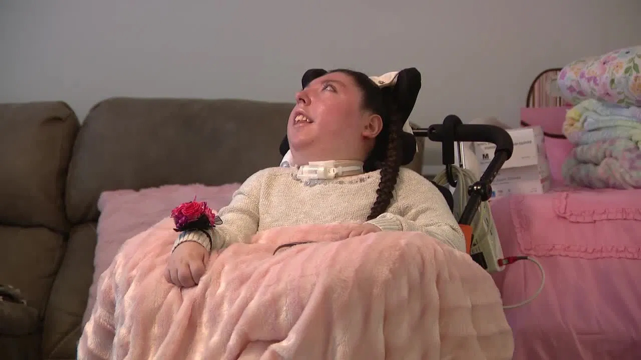 Nasceu sem parte do cérebro e os médicos deram-lhe 4 anos de vida — acaba de fazer 20. Conheça a história