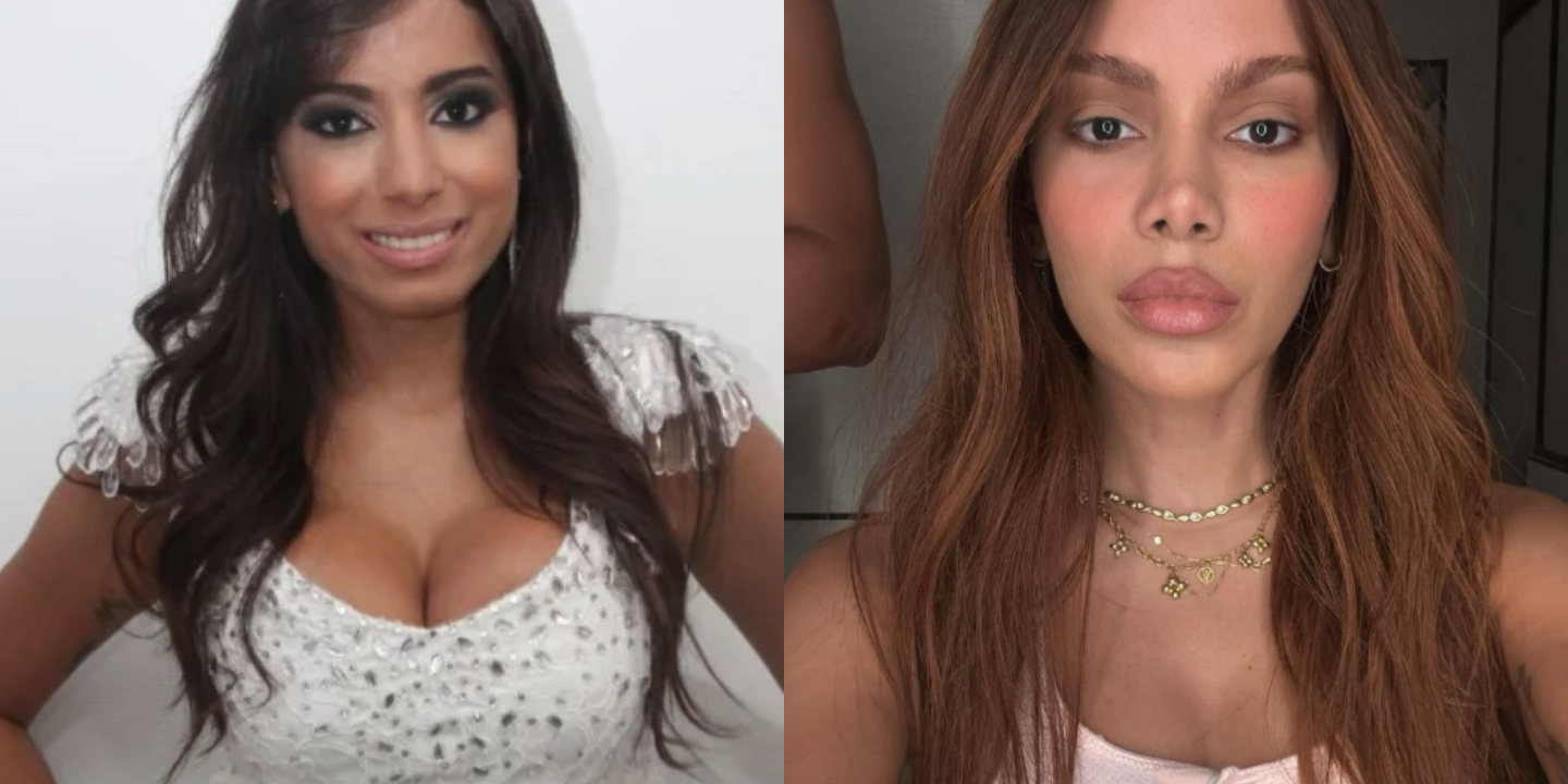 Anitta voltou a mexer na cara (e de que maneira). Estas 20 fotos mostram como mudou o rosto da cantora ao longo dos anos