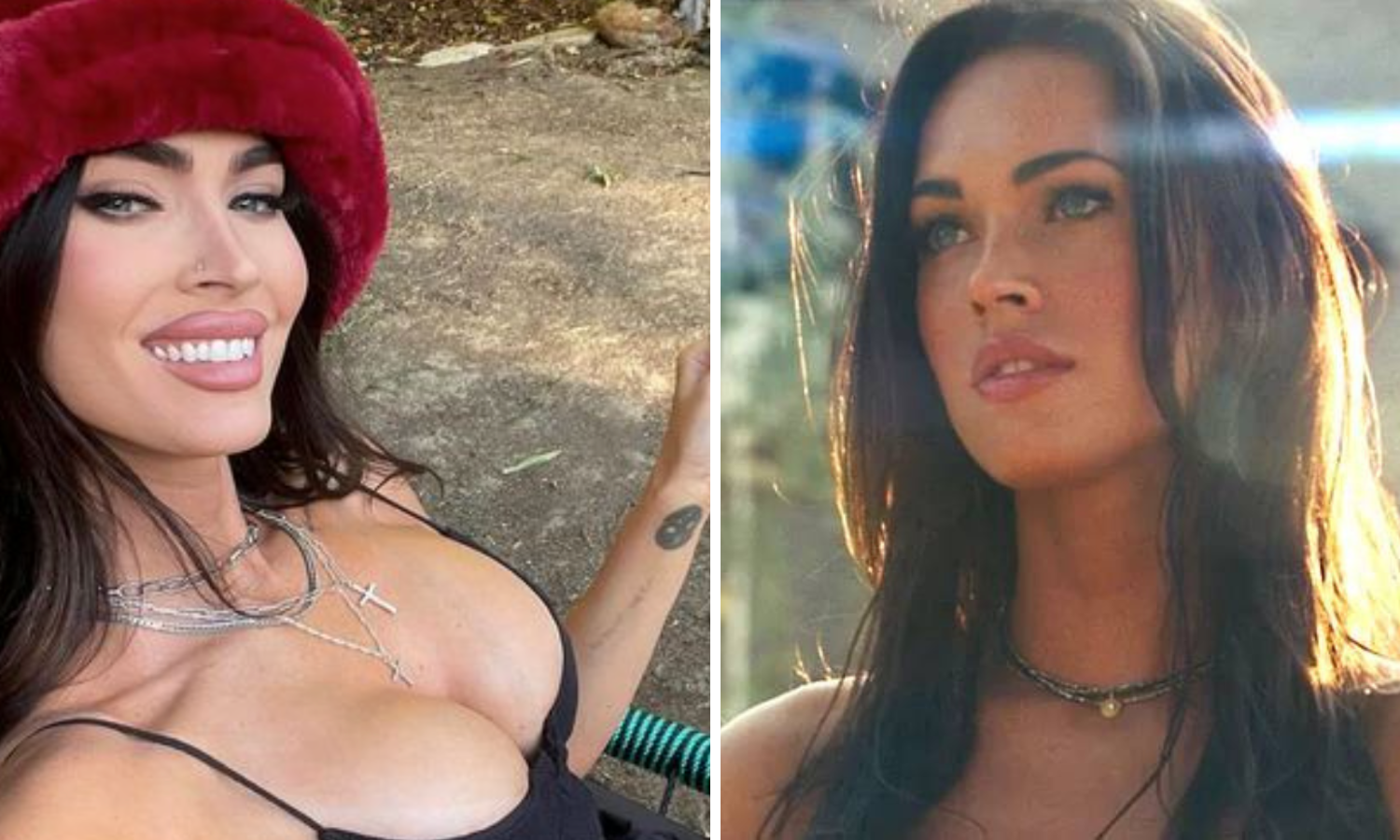 Para com isso Megan Fox! Fãs pedem que a atriz para com as plásticas e dizem que já parece uma Kardashian