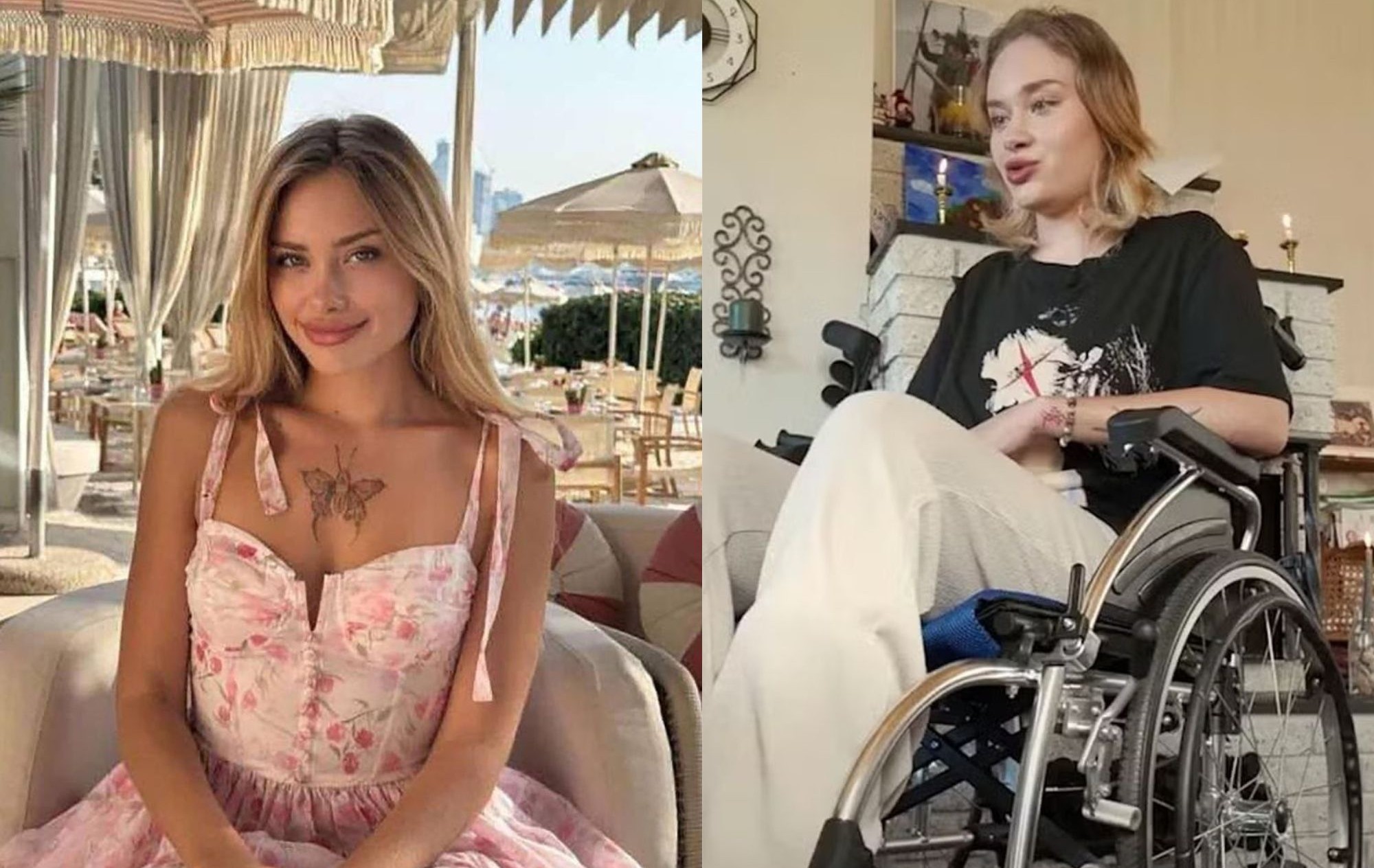 Festas degradantes e que envolvem fezes deixam modelo de 20 anos em cadeira de rodas e desfigurada