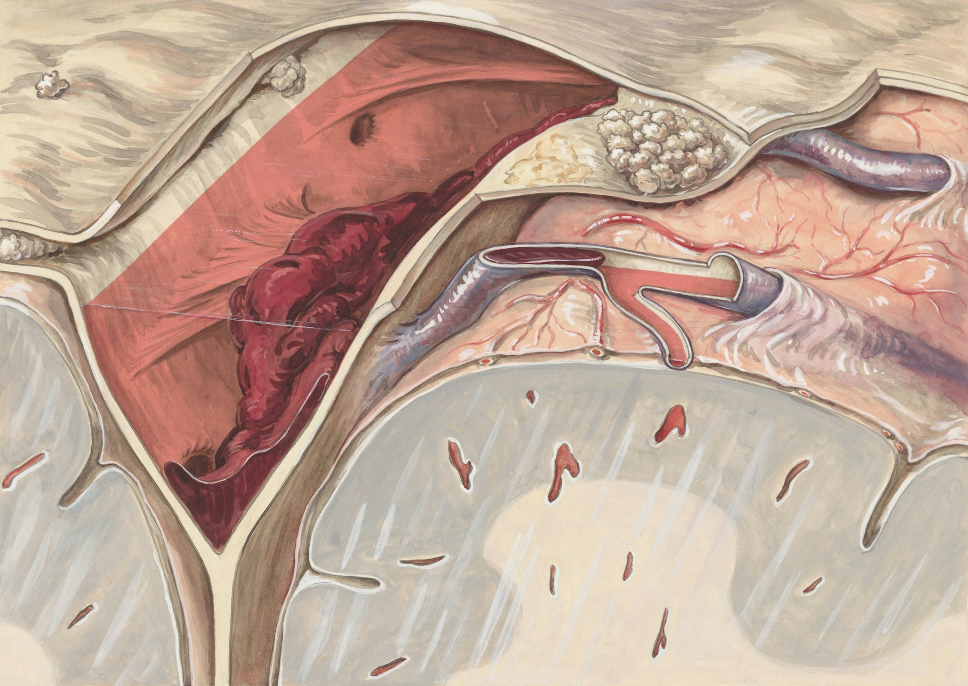 Cientistas portugueses estão a usar machine learning para ajudar a prever enfartes e AVC