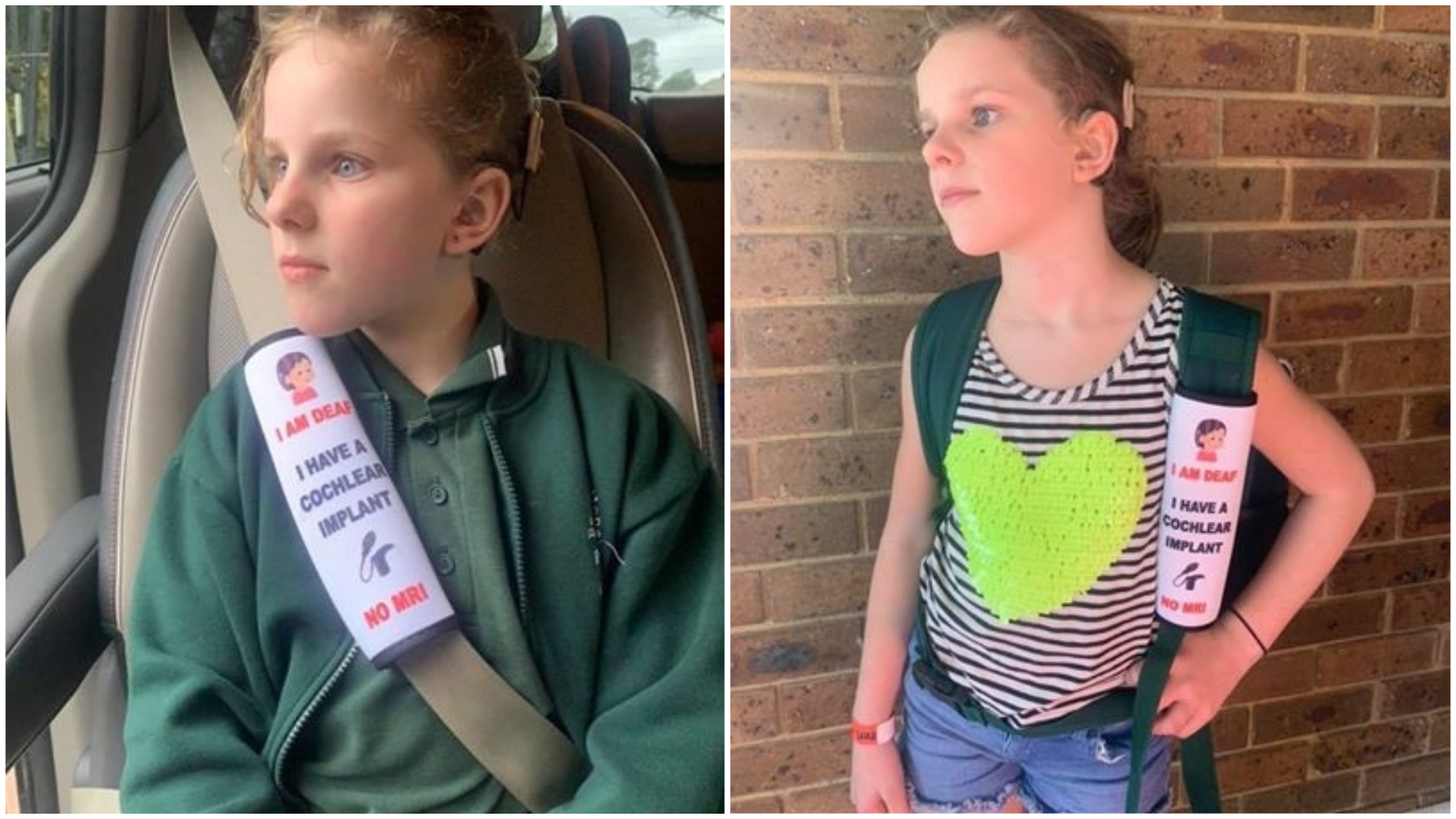 Mãe cria cintos personalizados para crianças com deficiência